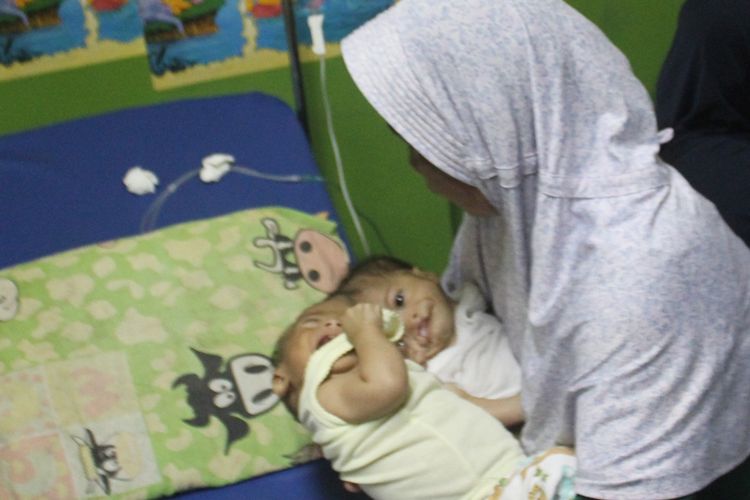 Bayi kembar siam dempet kepala, Fadlan dan Fadli di pangkuan bibinya saat menjalani perawatan medis di IGD RSUD Sayang, Cianjur, Kamis (22/08/2019). Kedua bayi malang itu kini telah dirujuk ke RSHS Bandung guna tindakan medis lanjutan.