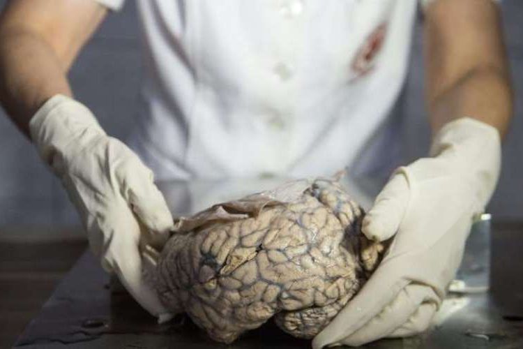 Doctor Diana Rivas menunjukkan otak manusia beku di Museum of Neuropathology, Lima, Peru, pada 16 November 2016.