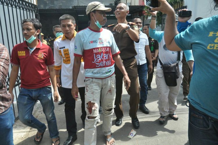 Salah satu korban luka akibat ledakan di halaman kantor Kejari Makassar saat pemusnahan barang bukti,  Rabu (11/4/2018).