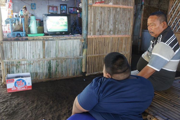Satia Putra, bocah tujuh tahun dengan berat 97 kilogram asal Kampung Cilempung, Desa Pasirjaya, Kecamatan Cilamaya Wetan, Kabupaten Karawang tengah makan, Senin (1/7/2019).