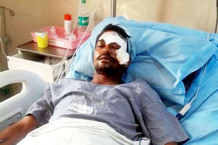 Ashok Nilmakar harus kehilangan separuh penglihatannya setelah mata kirinya ditikam dalam sebuah perkelahian.