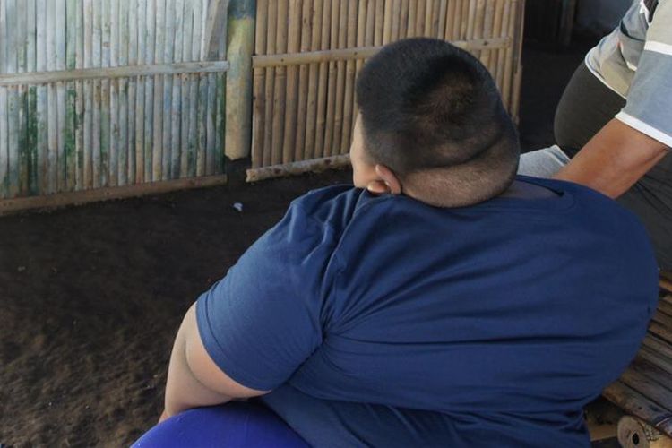 Satia Putra, bocah tujuh tahun dengan berat 97 kilogram asal Kampung Cilempung, Desa Pasirjaya, Kecamatan Cilamaya Wetan, Kabupaten Karawang tengah menonton televisi, Senin (1/7/2019).

