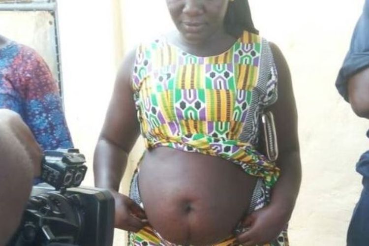 Para perempuan korban dukun di Guinea itu kini perutnya membuncit seperti sedang hamil.