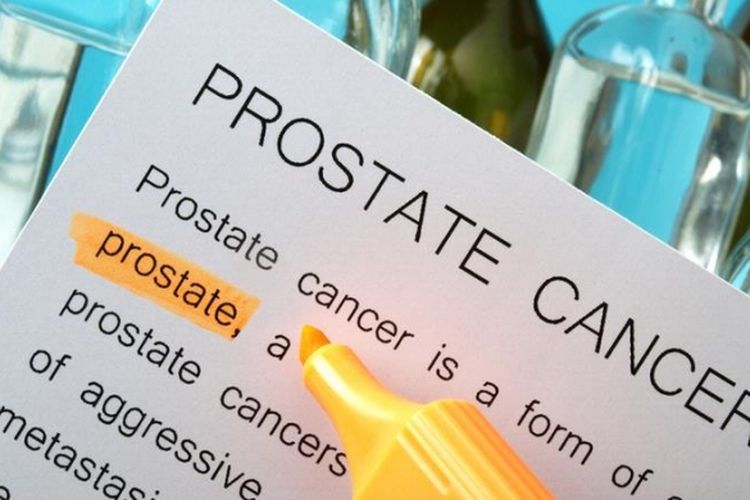 Ilustrasi kanker prostat
