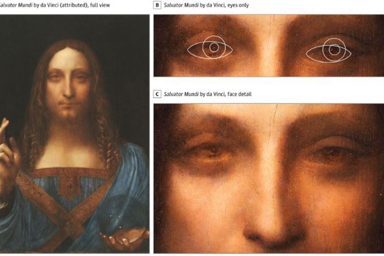 Analisis lukisan Salvator Mundi yang memberikan bukti bahwa Leonardo da Vinci miliki kondisi mata strabismus
