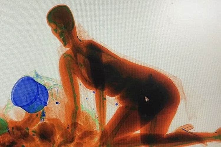 Penampakan tubuh perempuan yang terlihat melalui mesin x-ray setelah seorang perempuan nekat ingin ikut masuk ke dalam mesin untuk menjaga barang bawaannya.