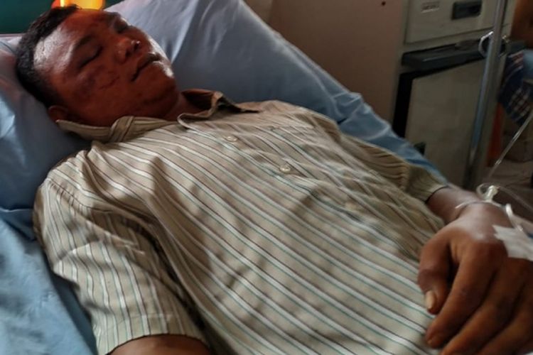  Harismail alias Ujang (25)korban salah tangkap oleh oknum Polisi saat menjalani perawatan di Rumah Sakit Bhayangkara Palembang, Sumatera Selatan, Minggu (24/2/2019).