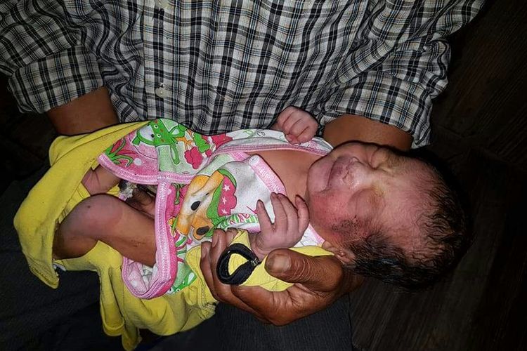 Inilah bayi berjenis kelamin laki-laki yang dibuang dan ditemukan di depan kios tambal Jalan Ir Juanda, Kampung Sewu, Kecamatan Jebres, Kota Solo, Selasa (27/2/2018).