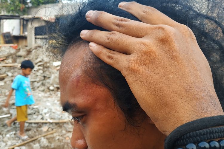 Pemerintah Kota Bekasi kembali melakukan penggusuran di Jakasetia, Bekasi Selatan, Senin (2/9/2019). Salah seorang mahasiswa pendamping warga dikeroyok dan dihantam balok pada pelipisnya.