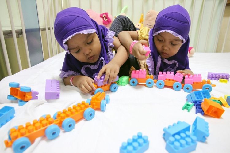 Balita kembar siam asal Garut, Al Putri Anugrah (Putri) dan Al Putri Dewiningsih (Dewi) saat dirawat di ruang Kemuning, RS Hasan Sadikin Bandung, Senin (28/8/2017).