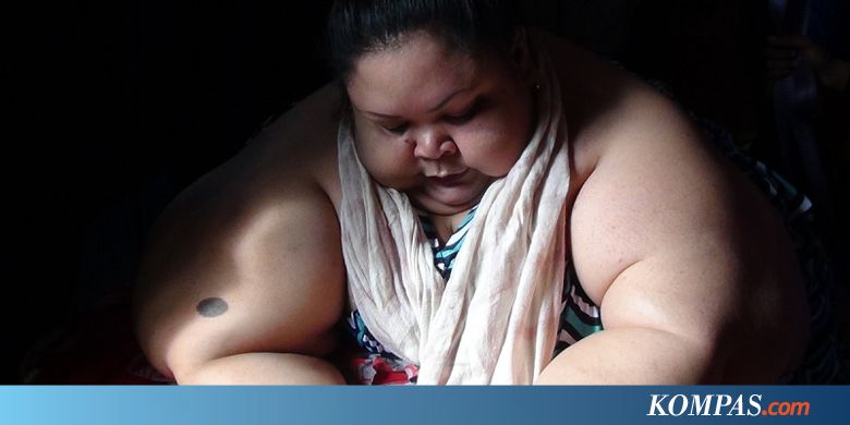 5 Fakta Titin, Penderita Obesitas 300 Kg di Palangkaraya