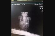 Pengakuan Mantan Gundik yang Pernah Mabuk Bersama Sultan 