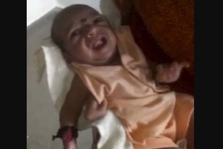 Bayi perempuan yang terlahir dengan satu tangan tambahan ini dipuja sebagai titisan dewa oleh warga di India.