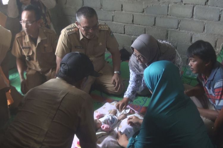 Bupati Muara Enim Ahmad Yani menjenguk bayi Nur Haqiqi yang terlahir tanpa lubang anus dan kondisi bibir sumbing. Ahmad Yani memastikan seluruh biaya operasi ditanggung pihak Pemkab Muara Enim, Rabu (9/1/2019). 
