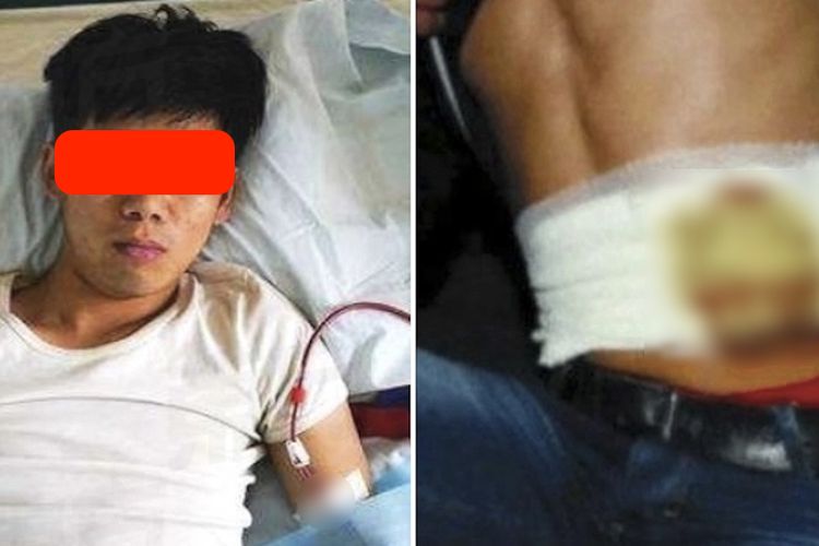 Xiao Wang, pria asal China (24) harus menjalani sisa hidupnya dengan perawatan cuci darah setelah tujuh tahun lalu menual ginjalnya demi sebuha iPhone 4.