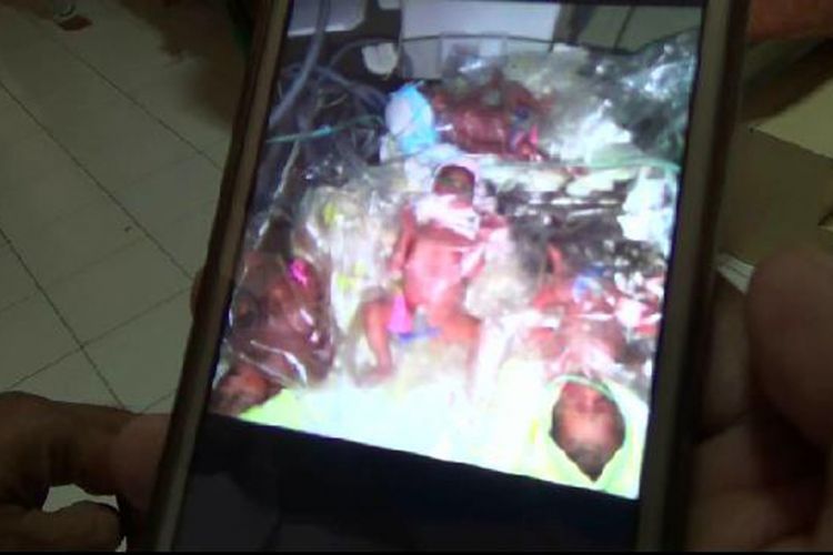 Bayi kembar empat berjenis kelamin perempuan yang lahir di RSBT Pangkal Pinang, Kepulauan Bangka Belitung.