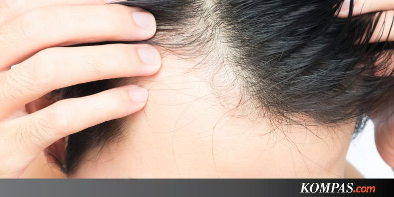 Cegah Kebotakan Khas Pria dengan 5 Tips Ini