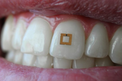 'Wearable' Ini Bisa Tahu Kebiasaan Makan dan Merokok