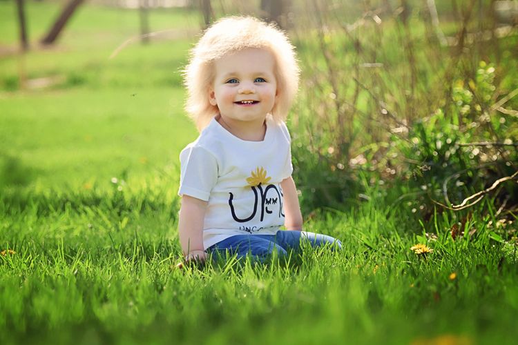 Taylor Mcgowan, balita 18 bulan yang alami mutasi genetik langka bernama sindrom rambut tak bisa disisir.