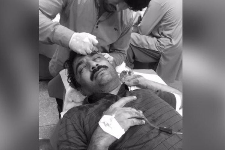 Ahmad Noorani mendapat perawatan dari petugas medis. Noorani adalah jurnalis yang menjadi korban serangan Jumat (27/10/2017)