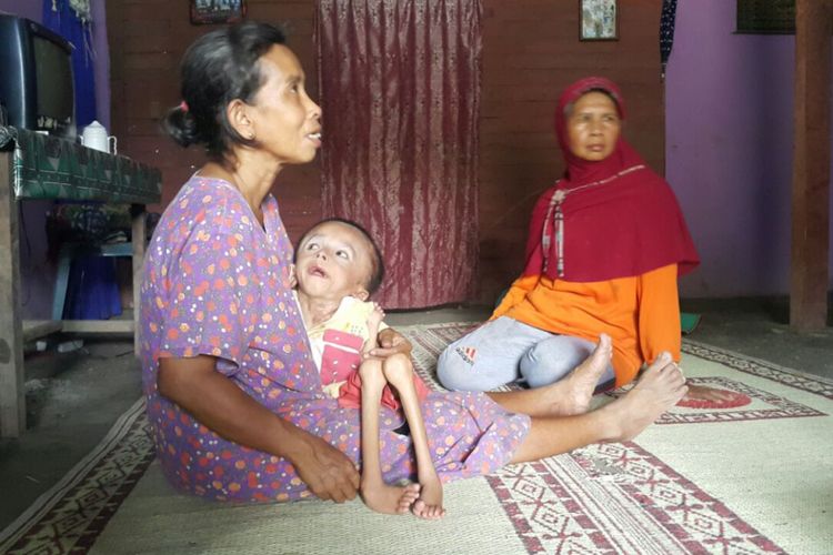 GENDONG ANAKNYA --Daminah (48), menggendong Nur Rohim (12) anak ketiganya yang terserang hidrosipalus. Meski berusia 12 tahun, berat badan Rohim hanya tujuh kilogram. 