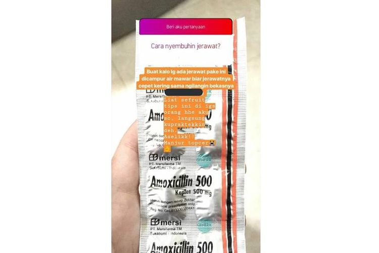 Beredar Isu antibiotik Amoxilin digunakan sebagai obat jerawat di media sosial Twitter pada Jumat (21/6/2019).