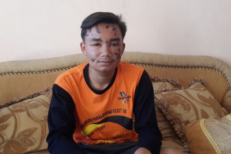 Viki Mahardika, atlet paralayang korban selamat gempa Palu, Sulawesi Tengah saat ditemui di rumahnya, Kota Batu, Rabu (3/9/2018).