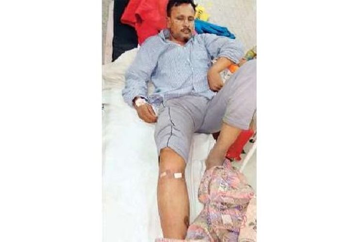 Vijendra Tyagi, pasien yang harus dioperasi kakinya padahal dia menderita luka di kepala.