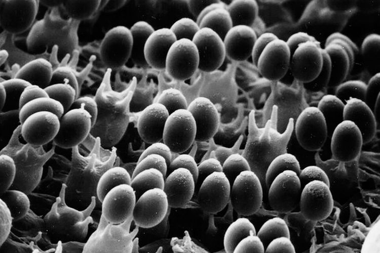 Foto mikroskopis spora yang siap diluncurkan