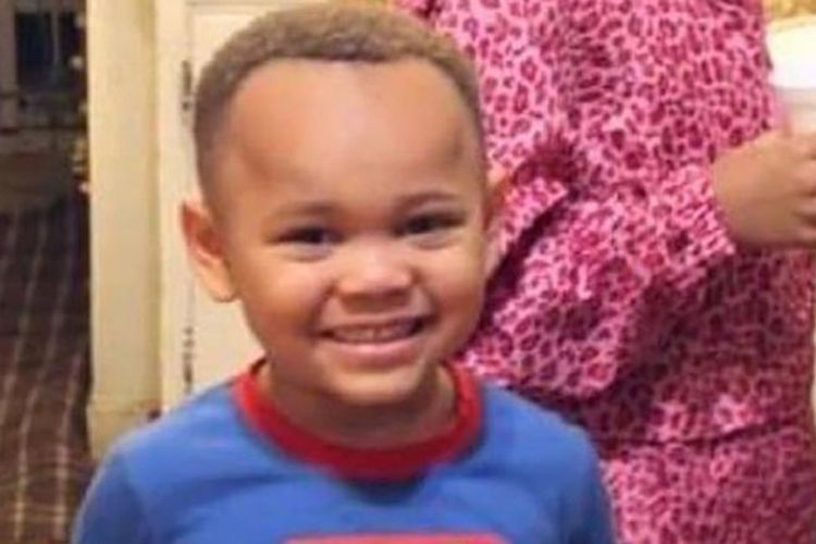 Navaun Jackson. Bocah empat tahun asal Oakland, Amerika Serikat (AS), yang dirawat setelah tak sengaja menembak kepala sendiri dengan pistol.