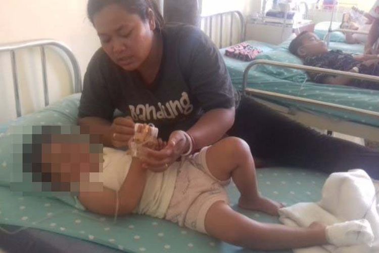 Sartika Br Sembiring berusaha menenangkan anaknya, Nabila Br Ketaren yang dirawat di Rumah Sakit Patar Asih Beringin akibat terjepit eskalator di Bandara Kualanamu, Selasa (31/10/2017). 