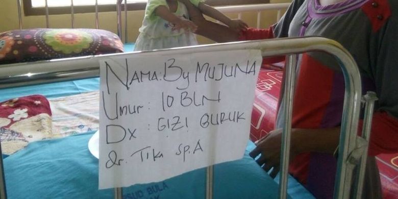 Dua bayi penderita gizi buruk di rawat di rumah sakit umum daerah (RSUD) Bula Kabupaten Seram Bagian Timur, Maluku, Sabtu (18/3/2017)