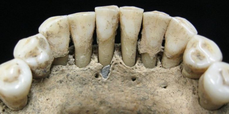 Gambar fosil gigi yang mengandung serpihan batu permata.