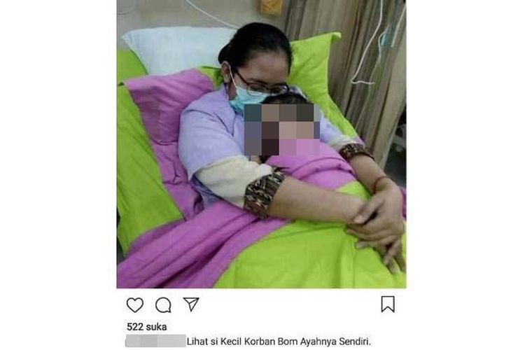 Foto anak korban bom di Bangil, Pasuruan, Jawa Timur, beredar di media sosial sejak Selasa (10/7/2018). Dalam foto tersebut, anak dengan wajah yang menghitam sedang dipangku oleh seorang perawat.
