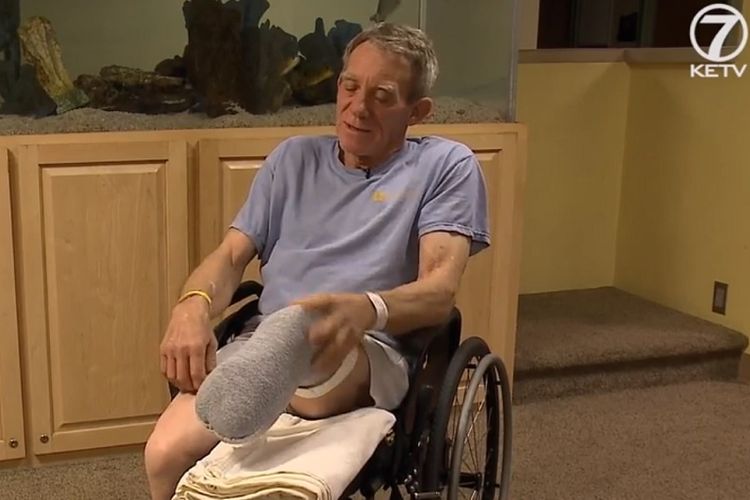 Kurt Kaser (63), petani asal Pender, Nebraska, menceritakan insiden yang membuatnya harus kehilangan kaki kirinya.