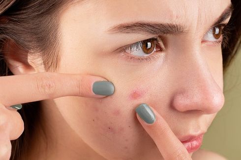 11 Penyebab Jerawat, Stres hingga Salah Pakai Skincare