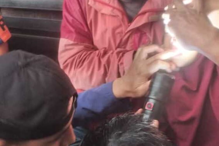 Tim rescue Diskar pb Kota Bandung tengah membantu mengeluarkan butir laher yang bersarang di dalam hidung Bocah 4 tahun, rabu (27/11/2024)