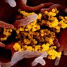 Virus Corona Bisa Hidup di Saluran Pernapasan 5 Minggu Pasca Penularan