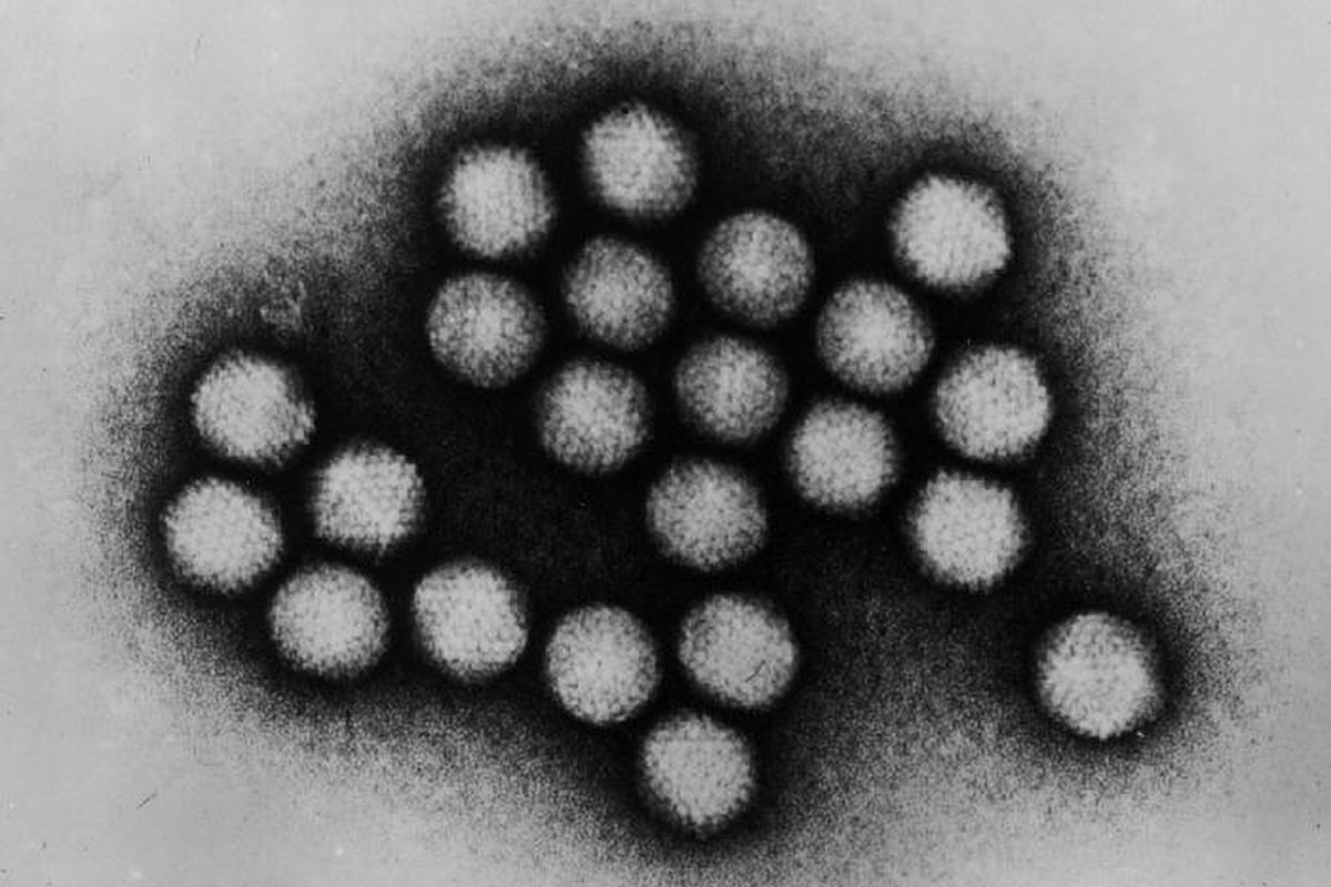 Adenovirus. Jenis virus ini sangat banyak dan menyebabkan berbagai penyakit. Umumnya, banyak menyebabkan flu dan pilek. Belakangan, kasus hepatitis akuut misterius pada anak, diketahui disebabkan oleh jenis virus Adenovirus 41.