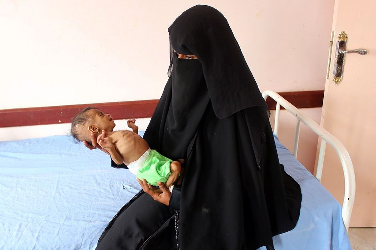 Seorang ibu di Yaman menggendong bayi perempuannya yang menderita kekurangan gizi di sebuah klinik di provinsi Hajjah utara Yaman pada 18 Desember 2019. 
Perang yang telah melanda Yaman telah merenggut puluhan ribu nyawa, memicu malnutrisi yang meluas dan apa yang disebut PBB sebagai krisis kemanusiaan terburuk di dunia.