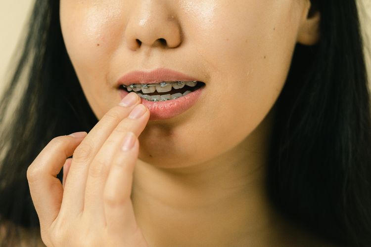 Simak penjelasan hukum Apakah gusi berdarah saat puasa membatalkan ibadah menurut mazhab Syafi?i.