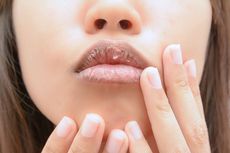 Cara Mencegah Bibir Kering Saat Berpuasa