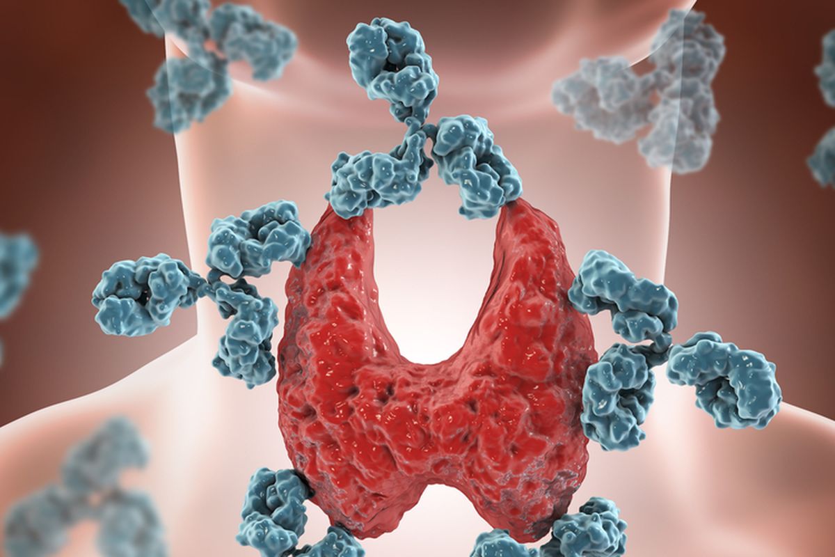 Ilustrasi penyakit autoimun tiroid.