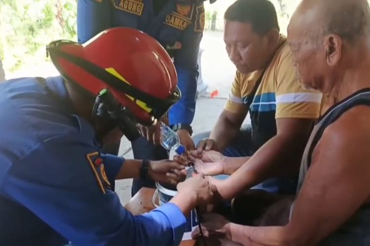 Jari Lansia di Madiun Bengkak gara-gara Cincin Melingkar Puluhan Tahun, Anak Panggil Damkar