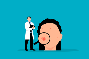 7 Cara Menghilangkan Jerawat Dari Hal Paling Dasar yang Sering Tidak Disadari