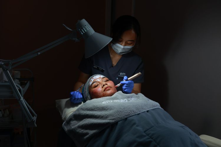 Perawatan untuk Atasi Jerawat dari Ringan hingga Parah, Ini Saran Dokter