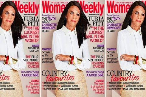 Wanita Berwajah Penuh Luka Bakar Jadi Model Majalah Gaya Hidup