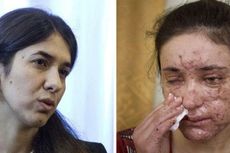 Dua Perempuan Yazidi Resmi Terima Hadiah Sakharov 