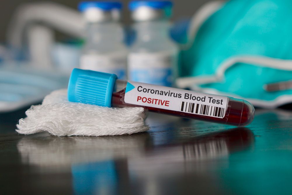 Virus Corona, Perancis Umumkan Kematian Pertama dari Warga Negaranya