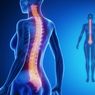 Osteoporosis: Pengertian, Penyebab, dan Cara Pengobatannya